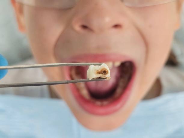 Best Cosmetic Emergency Dentistry in Stanwood, WA